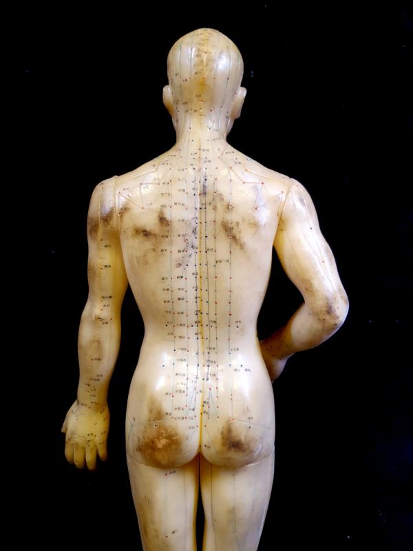 Antike chinesische Akupunktur-Statue - Plastik - Mann 2 4